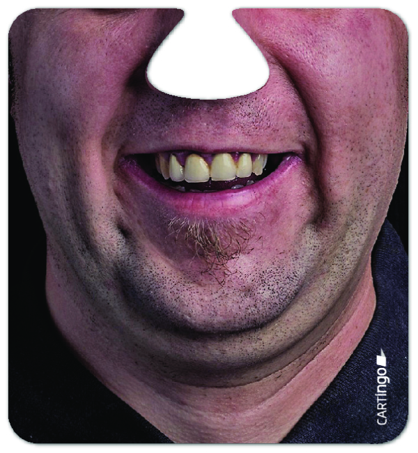 Facematt Partyset mit lustigen Gesichtern – Bild 9