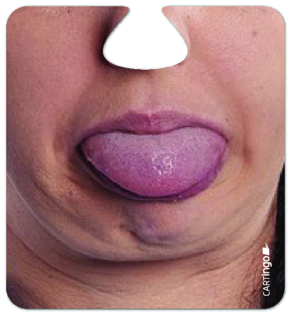 Facematt Partyset mit lustigen Gesichtern – Bild 11